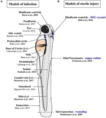 The Diverse Roles of Phagocytes During Bacterial and Fungal Infections and Sterile Inflammation: Lessons From Zebrafish